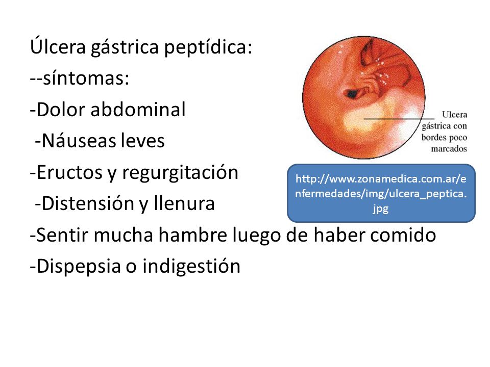 Úlcera gástrica peptídica: --síntomas: -Dolor abdominal -Náuseas leves -Eructos y regurgitación -Distensión y llenura -Sentir mucha hambre luego de haber comido -Dispepsia o indigestión