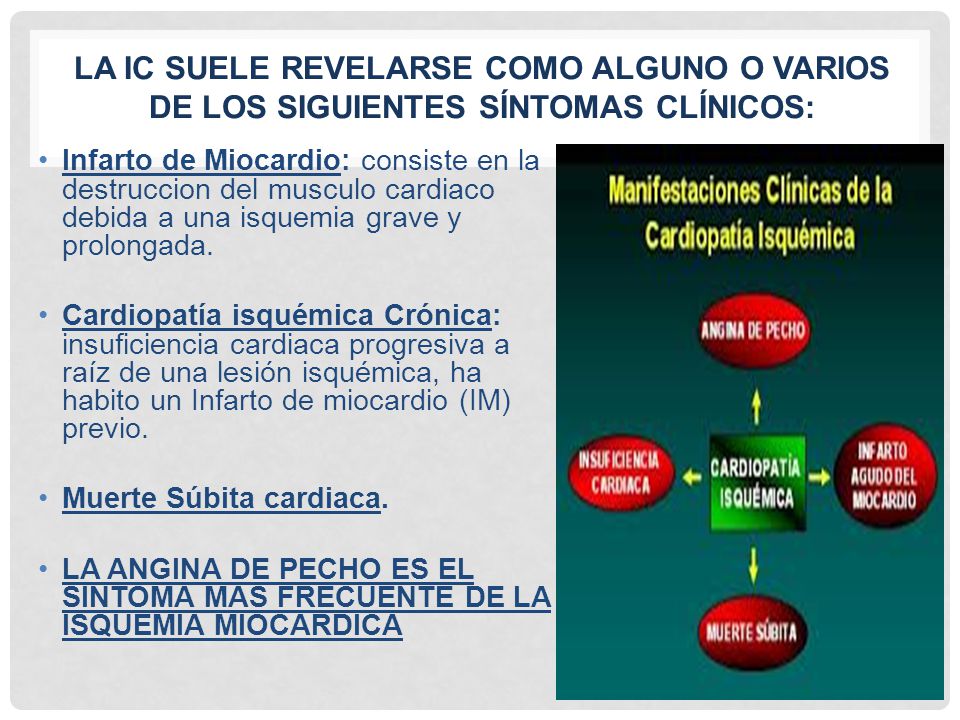 La Ic suele revelarse como alguno o varios de los siguientes Síntomas Clínicos: