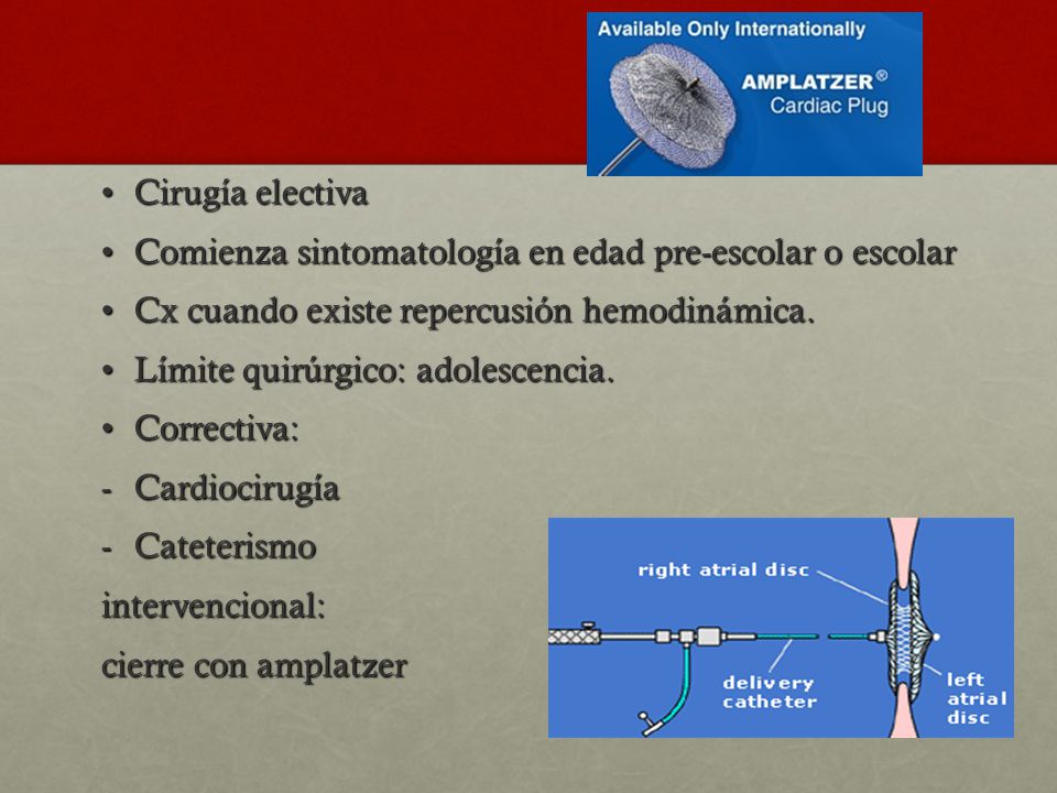 Cirugía electiva Comienza sintomatología en edad pre-escolar o escolar. Cx cuando existe repercusión hemodinámica.