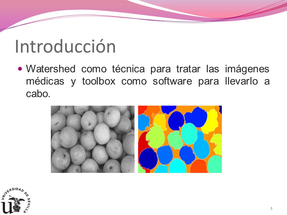 Introducción Watershed como técnica para tratar las imágenes médicas y toolbox como software para llevarlo a cabo.