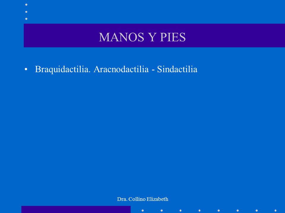 MANOS Y PIES Braquidactilia. Aracnodactilia - Sindactilia