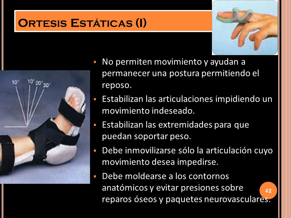 Ortesis Estáticas (I) No permiten movimiento y ayudan a permanecer una postura permitiendo el reposo.