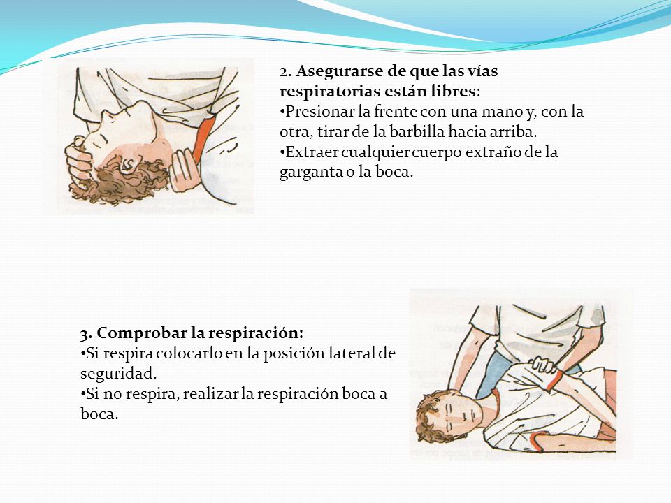 2. Asegurarse de que las vías respiratorias están libres: