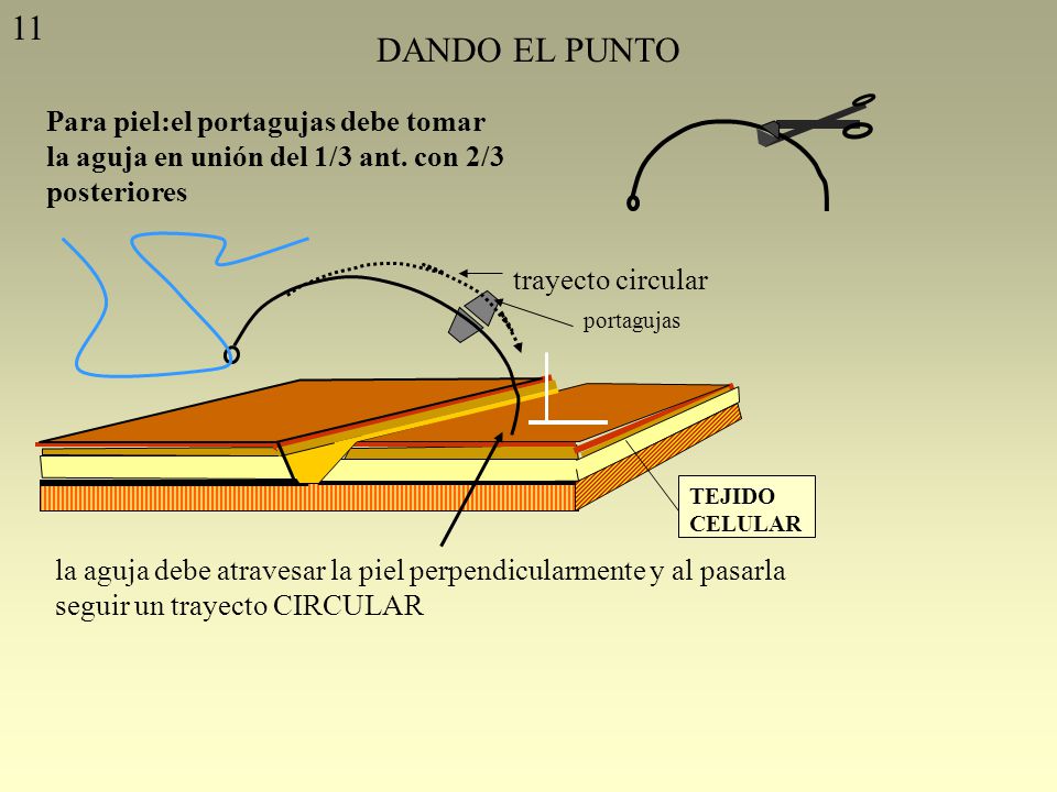 11 DANDO EL PUNTO. Para piel:el portagujas debe tomar la aguja en unión del 1/3 ant. con 2/3 posteriores.