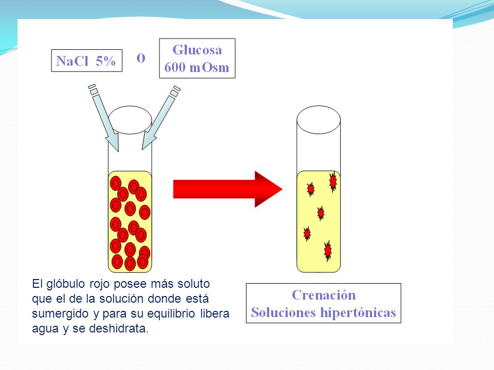 El glóbulo rojo posee más soluto que el de la solución donde está sumergido y para su equilibrio libera agua y se deshidrata.