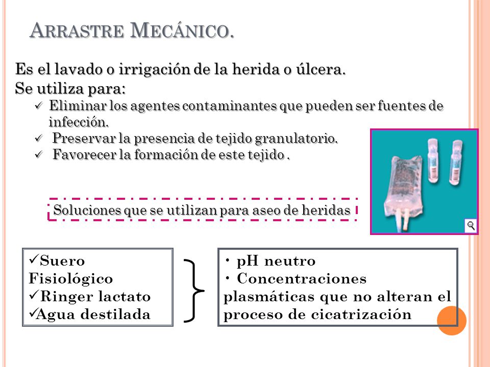 Arrastre Mecánico. Es el lavado o irrigación de la herida o úlcera.