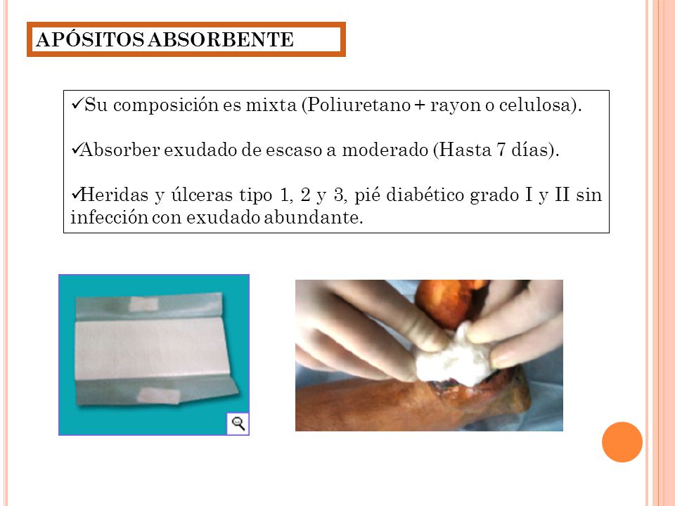 APÓSITOS ABSORBENTE Su composición es mixta (Poliuretano + rayon o celulosa). Absorber exudado de escaso a moderado (Hasta 7 días).