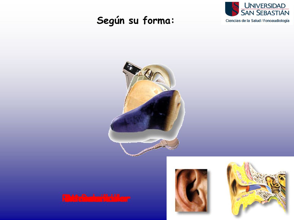 Según su forma: Retroauricular Intracanal Intraauricular De Bolsillo Microcanal