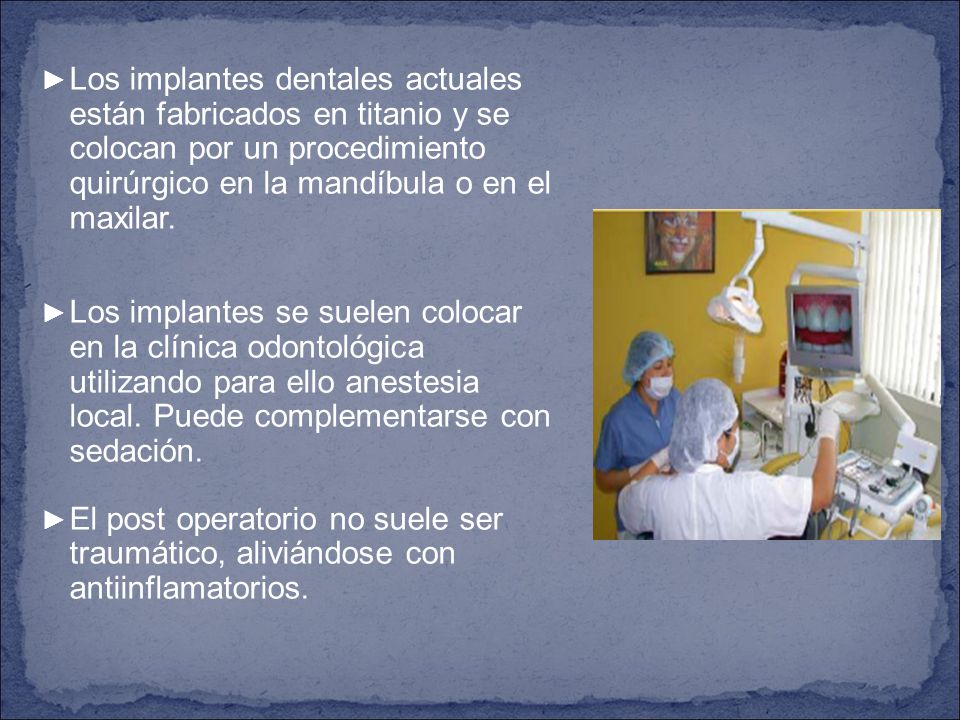 Los implantes dentales actuales están fabricados en titanio y se colocan por un procedimiento quirúrgico en la mandíbula o en el maxilar.