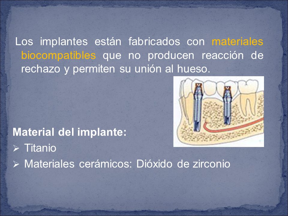 Los implantes están fabricados con materiales biocompatibles que no producen reacción de rechazo y permiten su unión al hueso.