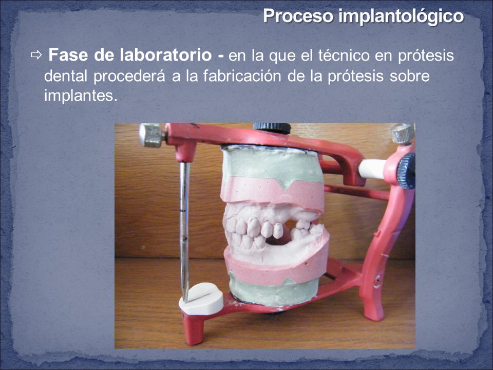 Fase de laboratorio - en la que el técnico en prótesis dental procederá a la fabricación de la prótesis sobre implantes.