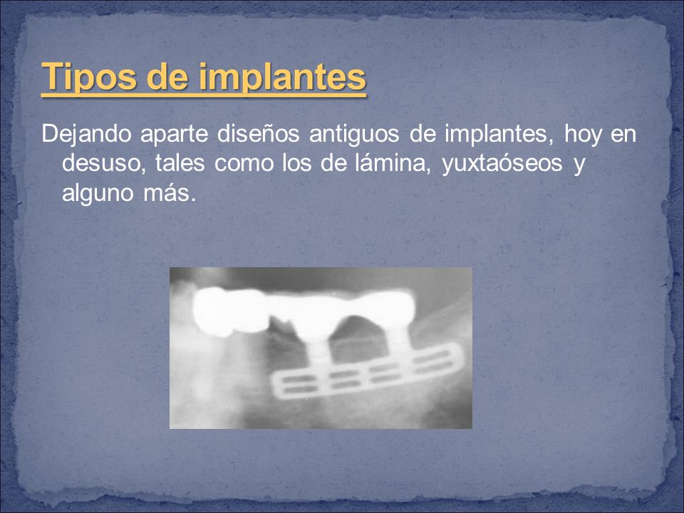 Dejando aparte diseños antiguos de implantes, hoy en desuso, tales como los de lámina, yuxtaóseos y alguno más.