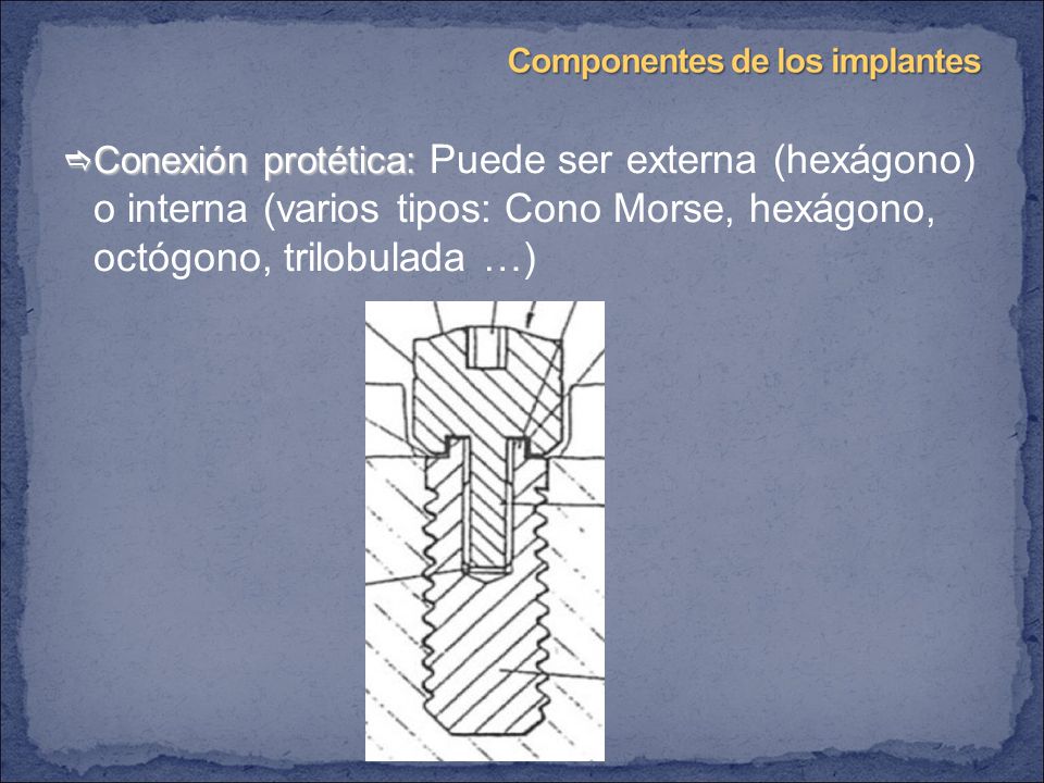 Conexión protética: Puede ser externa (hexágono) o interna (varios tipos: Cono Morse, hexágono, octógono, trilobulada …)