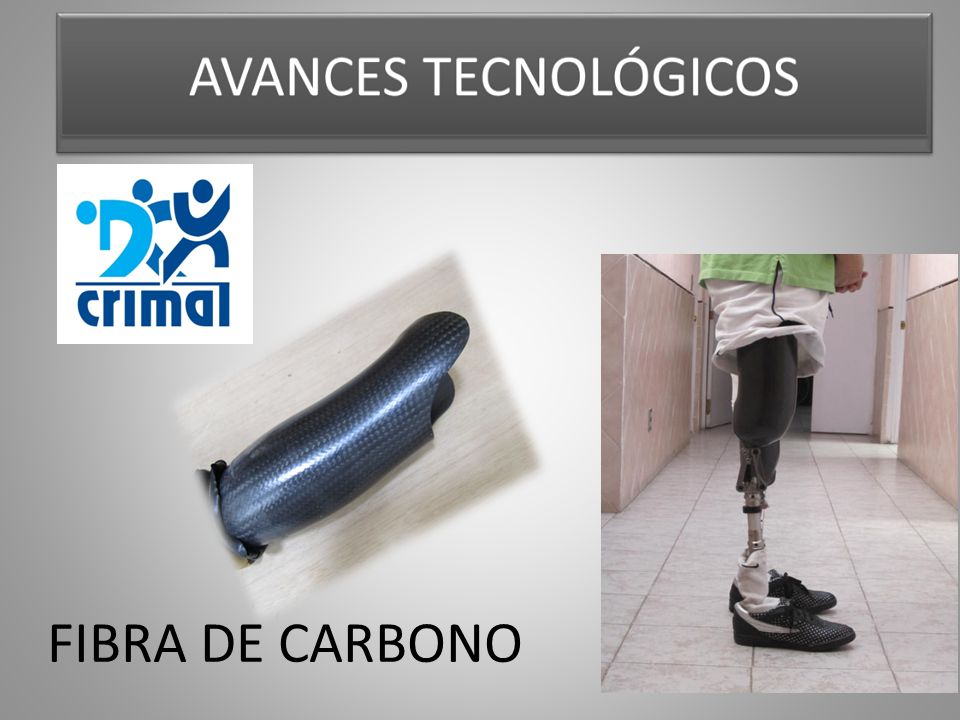 La introducción de las fibras de carbono para hacer las cuencas o sóquet mas ligeros y resistentes