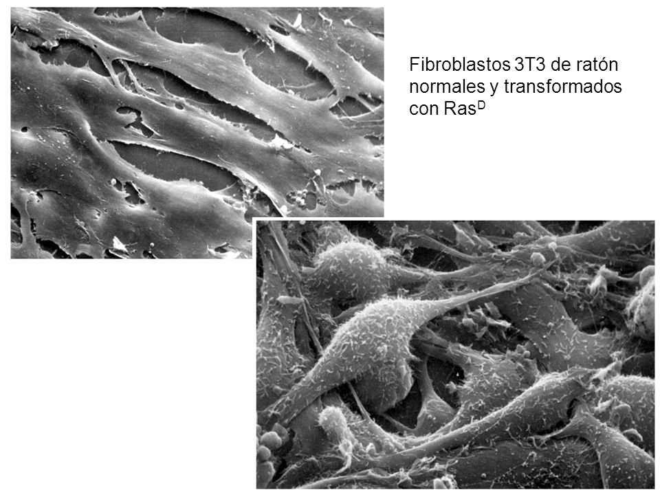 Fibroblastos 3T3 de ratón normales y transformados con RasD