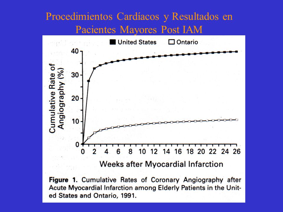 Procedimientos Cardíacos y Resultados en Pacientes Mayores Post IAM