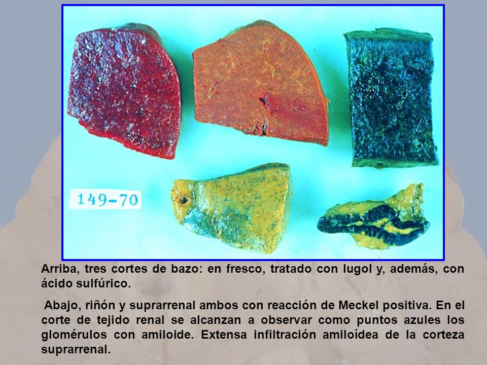 Arriba, tres cortes de bazo: en fresco, tratado con lugol y, además, con ácido sulfúrico.