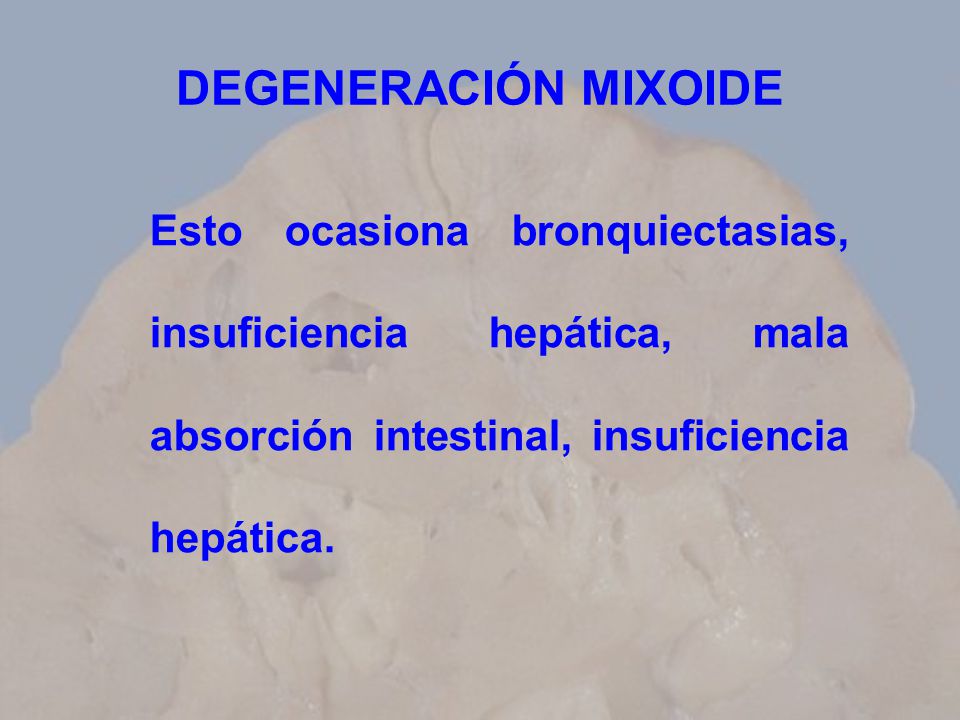 DEGENERACIÓN MIXOIDE Esto ocasiona bronquiectasias, insuficiencia hepática, mala absorción intestinal, insuficiencia hepática.