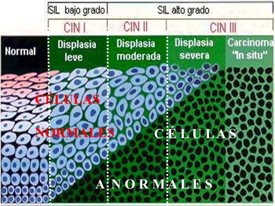 CÉLULAS NORMALES C É L U L A S A N O R M A L E S