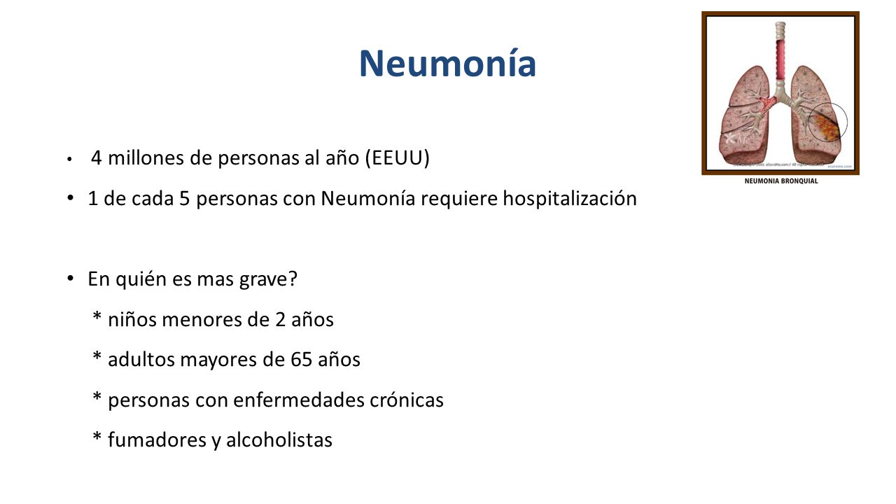 Neumonía 1 de cada 5 personas con Neumonía requiere hospitalización
