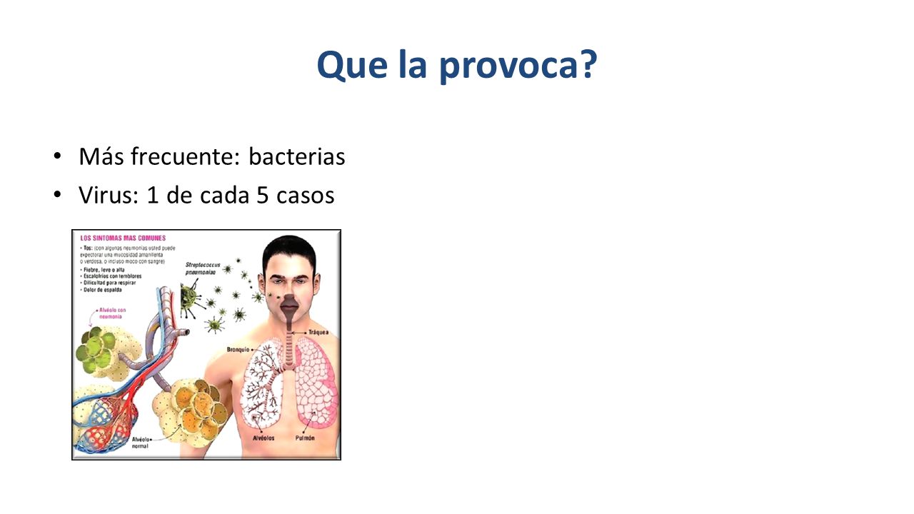 Que la provoca Más frecuente: bacterias Virus: 1 de cada 5 casos