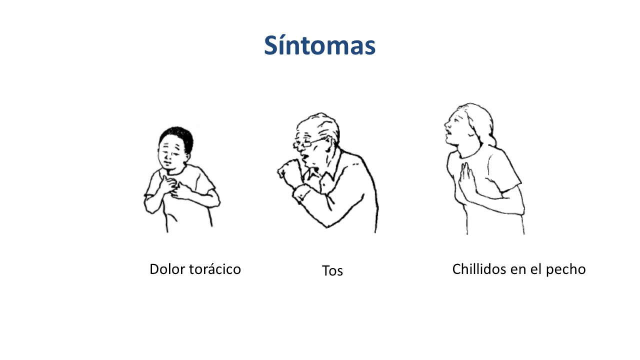 Síntomas Dolor torácico Tos Chillidos en el pecho