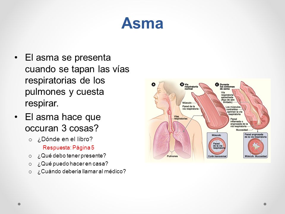 Asma El asma se presenta cuando se tapan las vías respiratorias de los pulmones y cuesta respirar. El asma hace que occuran 3 cosas