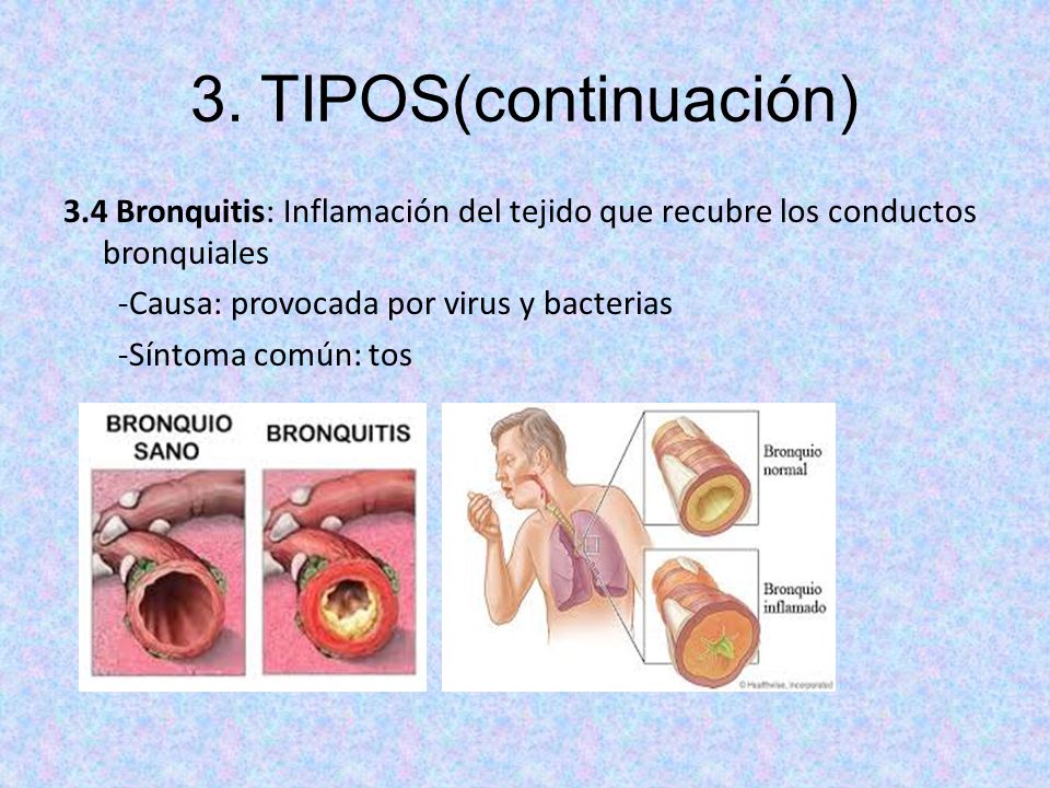 3. TIPOS(continuación) 3.4 Bronquitis: Inflamación del tejido que recubre los conductos bronquiales.