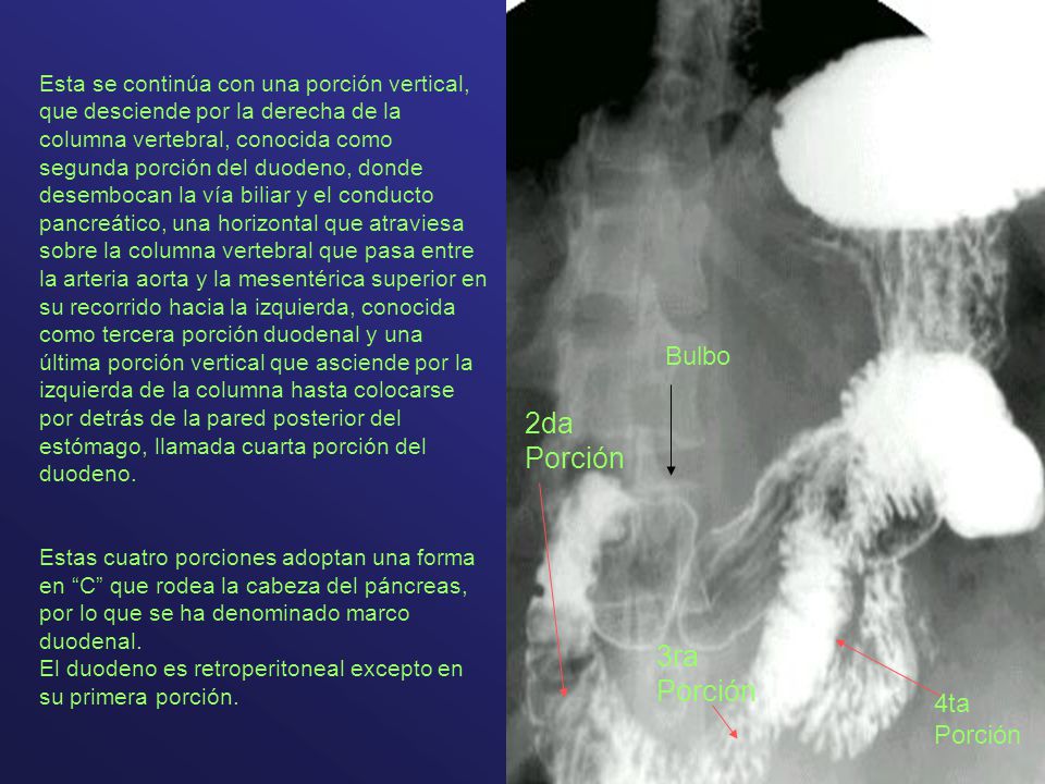 2da Porción 3ra Porción Bulbo 4ta Porción