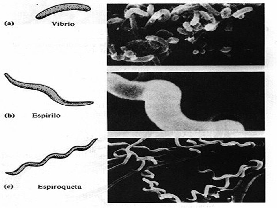 Diapositiva 18.- Se muestran algunas formas morfológicas dentro de las bacterias en forma de espiral.