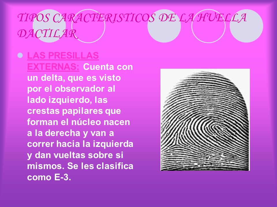 TIPOS CARACTERISTICOS DE LA HUELLA DACTILAR