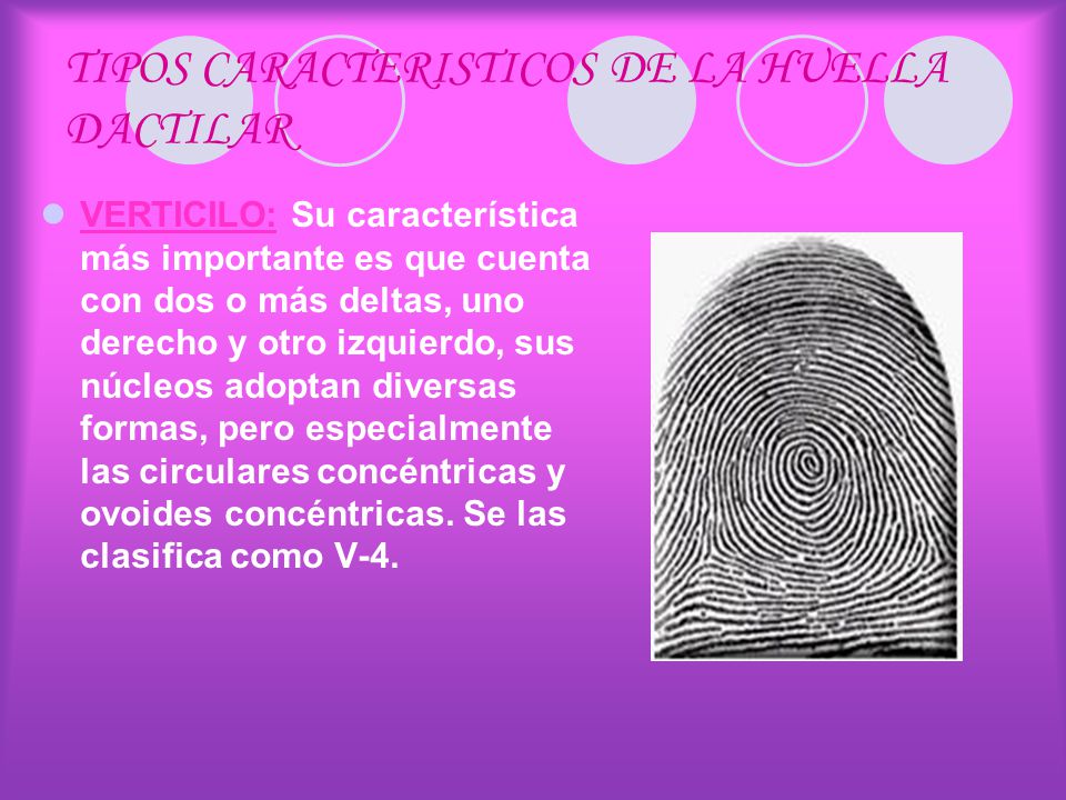 TIPOS CARACTERISTICOS DE LA HUELLA DACTILAR