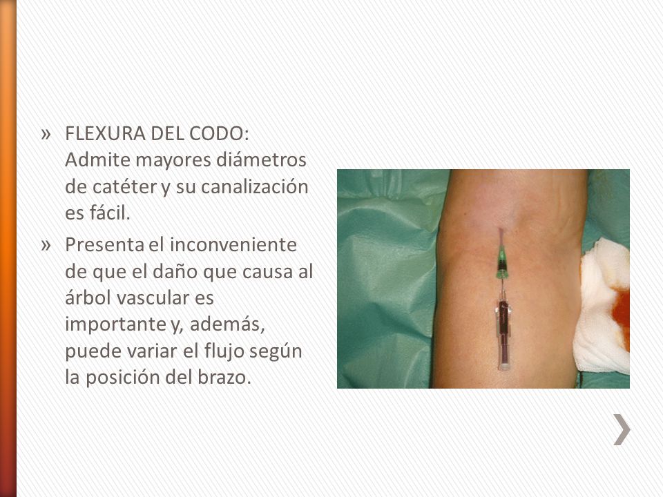 FLEXURA DEL CODO: Admite mayores diámetros de catéter y su canalización es fácil.