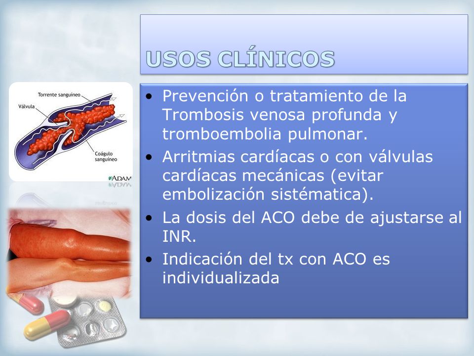 USOS CLÍNICOS Prevención o tratamiento de la Trombosis venosa profunda y tromboembolia pulmonar.