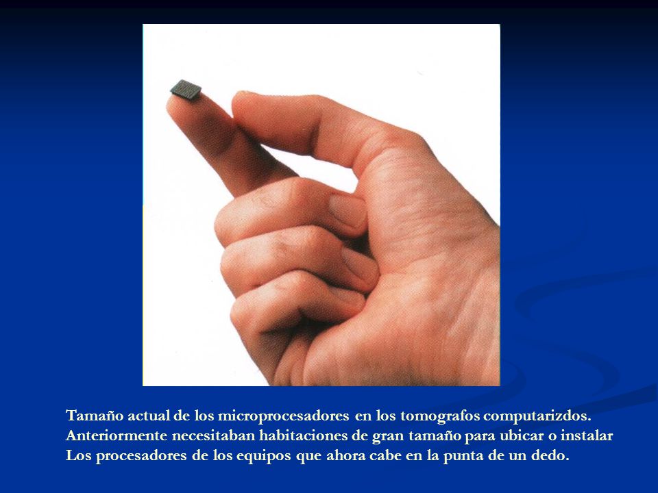 Tamaño actual de los microprocesadores en los tomografos computarizdos.