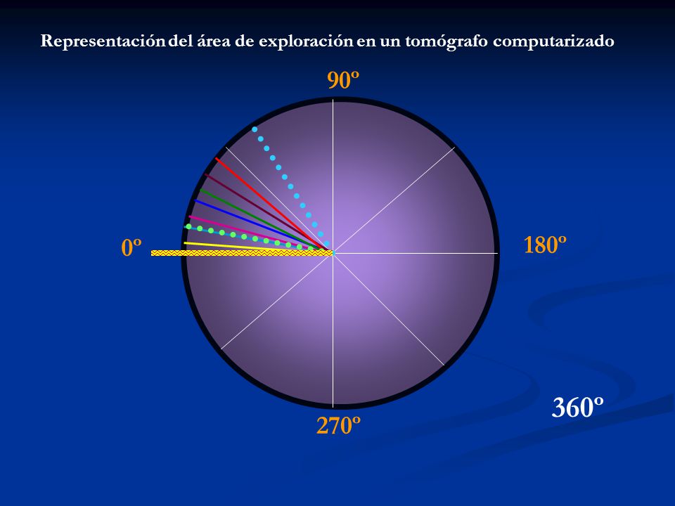 Representación del área de exploración en un tomógrafo computarizado