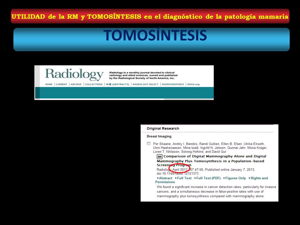 UTILIDAD de la RM y TOMOSÍNTESIS en el diagnóstico de la patología mamaria