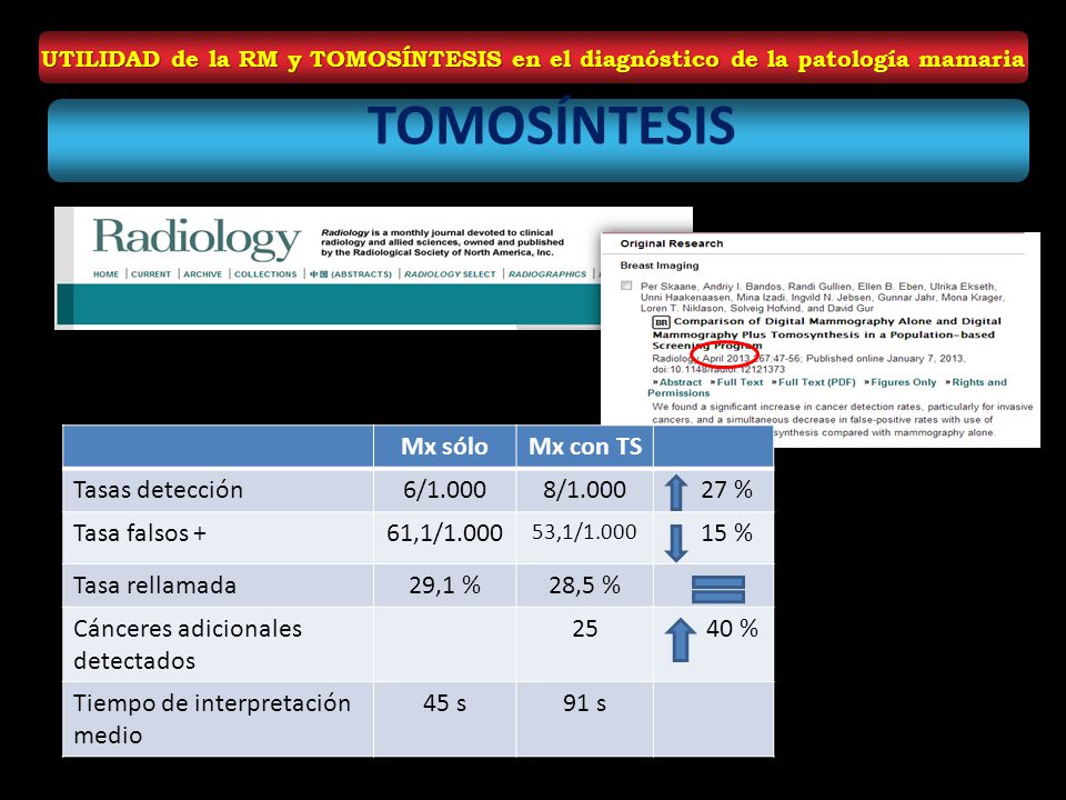 TOMOSÍNTESIS Mx sólo Mx con TS Tasas detección 6/ / %
