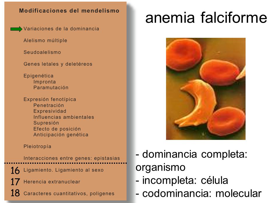 anemia falciforme dominancia completa: organismo - incompleta: célula