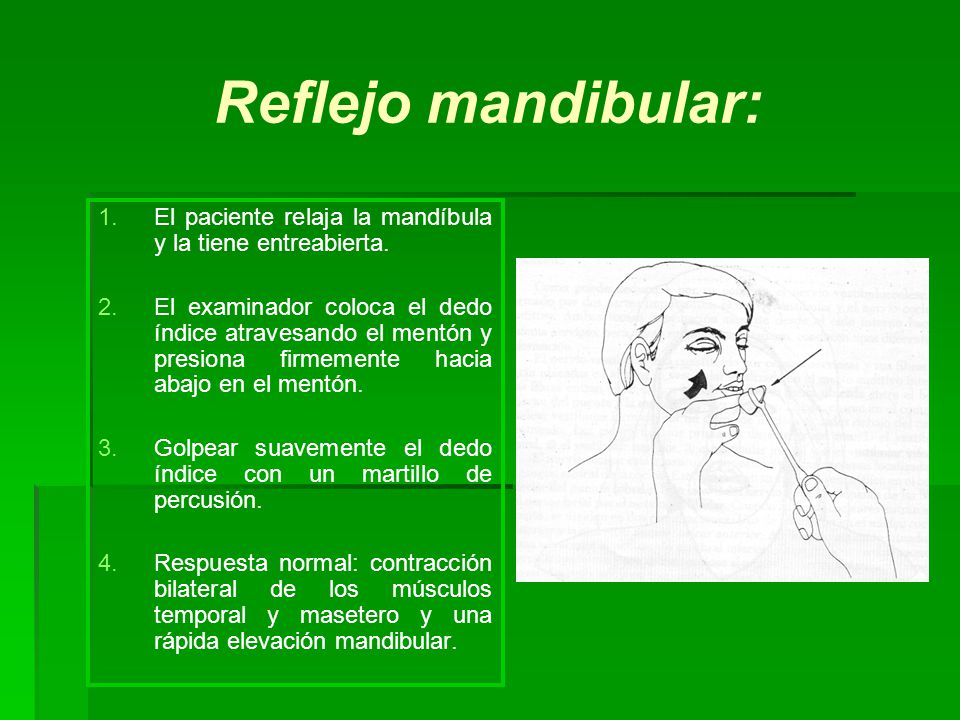 Reflejo mandibular: El paciente relaja la mandíbula y la tiene entreabierta.