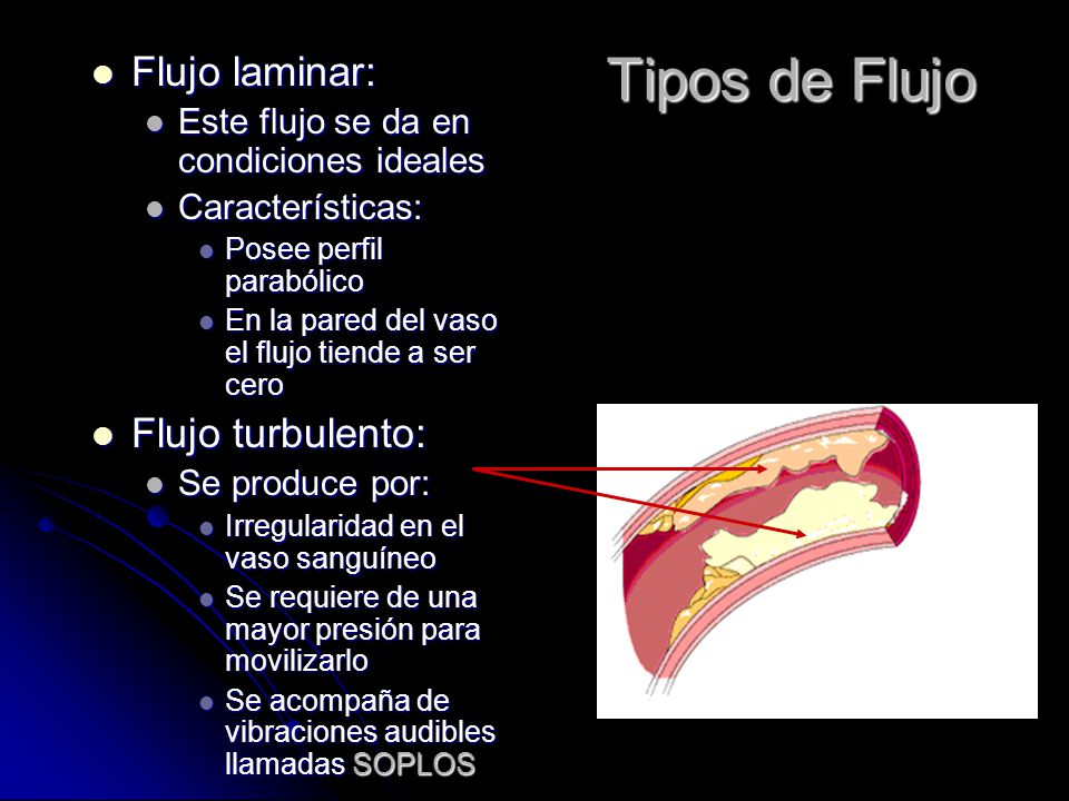 Tipos de Flujo Flujo laminar: Flujo turbulento: