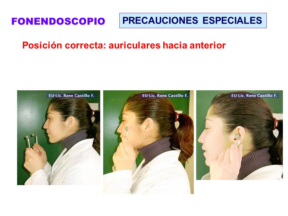 FONENDOSCOPIO PRECAUCIONES ESPECIALES Posición correcta: auriculares hacia anterior