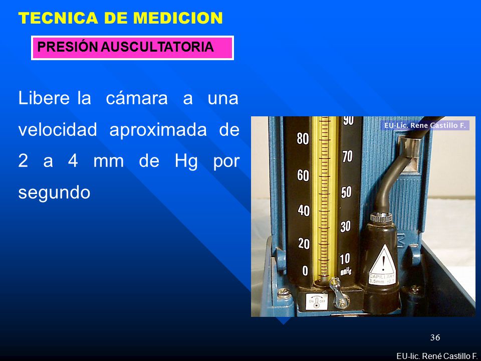 TECNICA DE MEDICION PRESIÓN AUSCULTATORIA. Libere la cámara a una velocidad aproximada de 2 a 4 mm de Hg por segundo.