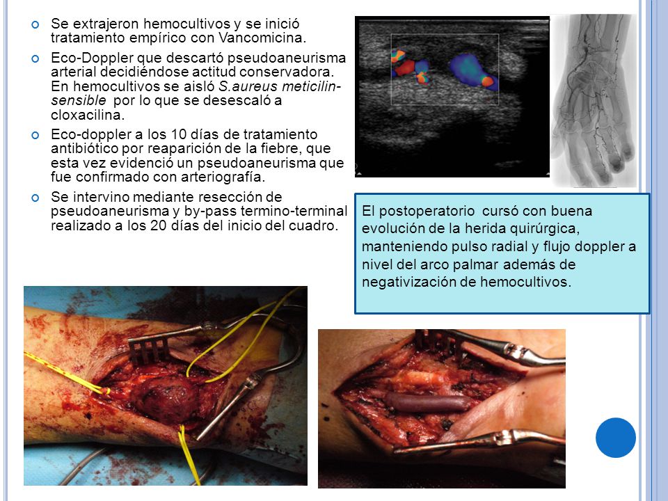 Se extrajeron hemocultivos y se inició tratamiento empírico con Vancomicina.
