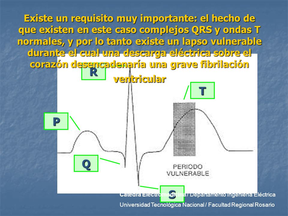 Existe un requisito muy importante: el hecho de que existen en este caso complejos QRS y ondas T normales, y por lo tanto existe un lapso vulnerable durante el cual una descarga eléctrica sobre el corazón desencadenaría una grave fibrilación ventricular