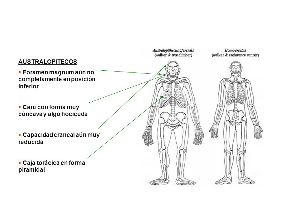 AUSTRALOPITECOS: Foramen magnum aún no completamente en posición inferior. Cara con forma muy cóncava y algo hocicuda.