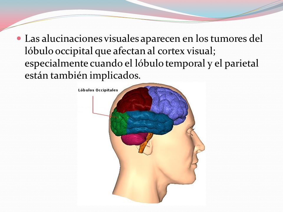 Las alucinaciones visuales aparecen en los tumores del lóbulo occipital que afectan al cortex visual; especialmente cuando el lóbulo temporal y el parietal están también implicados.