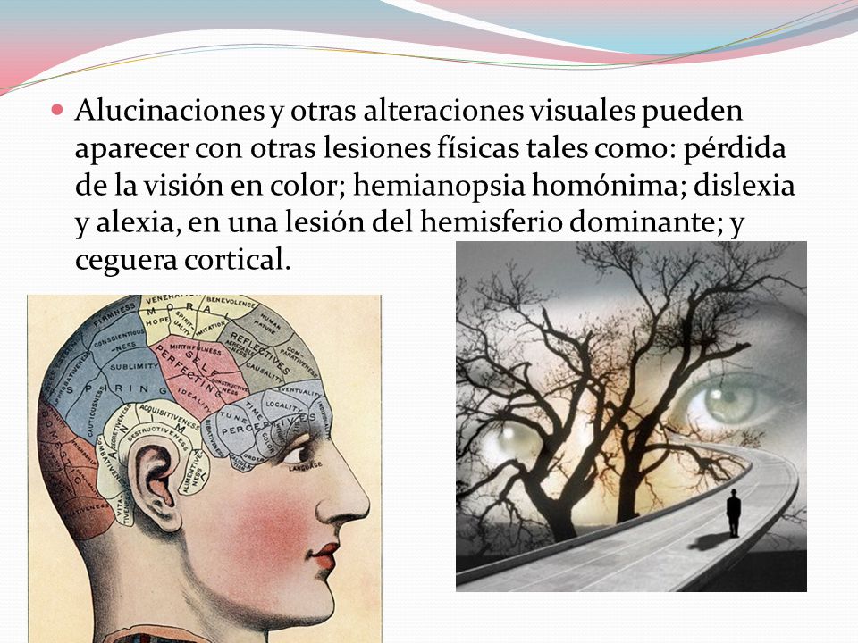 Alucinaciones y otras alteraciones visuales pueden aparecer con otras lesiones físicas tales como: pérdida de la visión en color; hemianopsia homónima; dislexia y alexia, en una lesión del hemisferio dominante; y ceguera cortical.