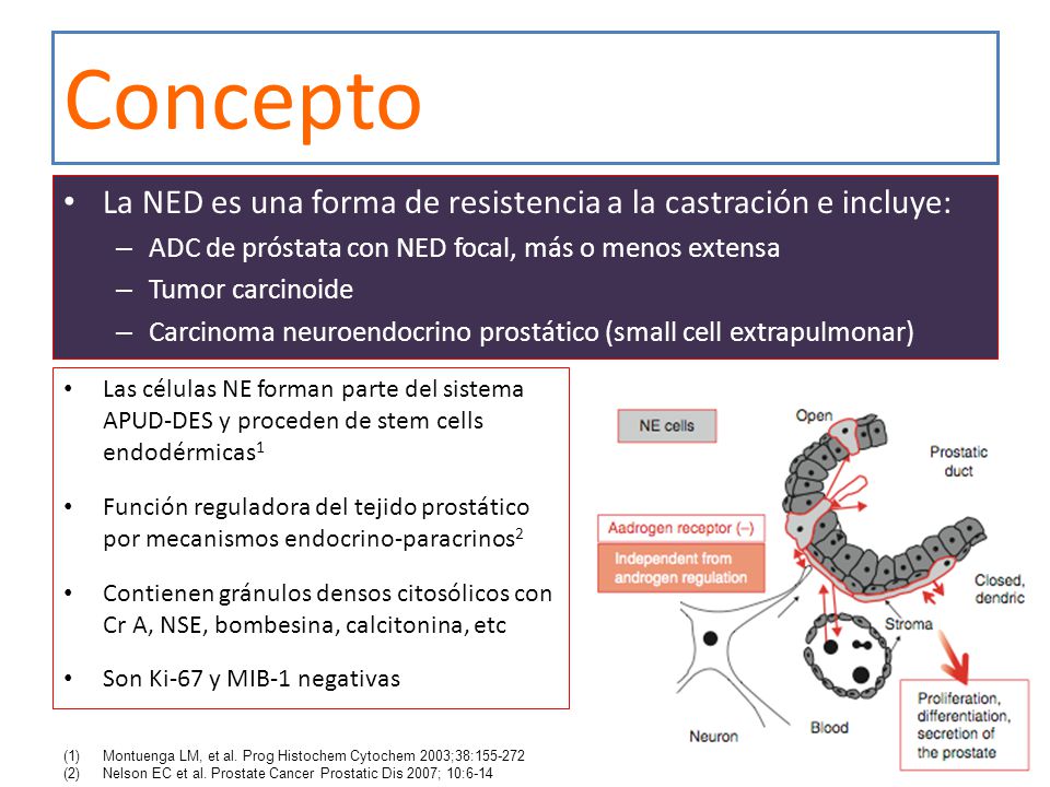 Concepto La NED es una forma de resistencia a la castración e incluye: