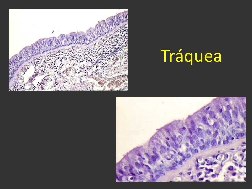Tráquea